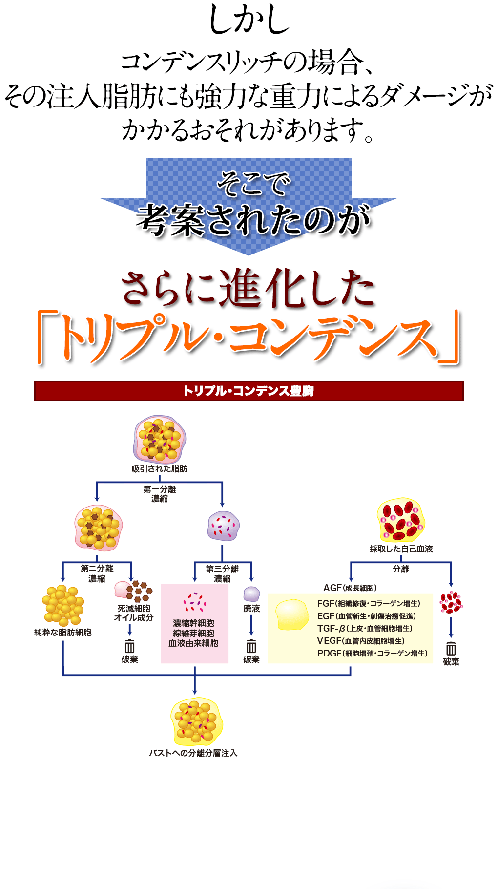 コンデンスリッチ豊胸