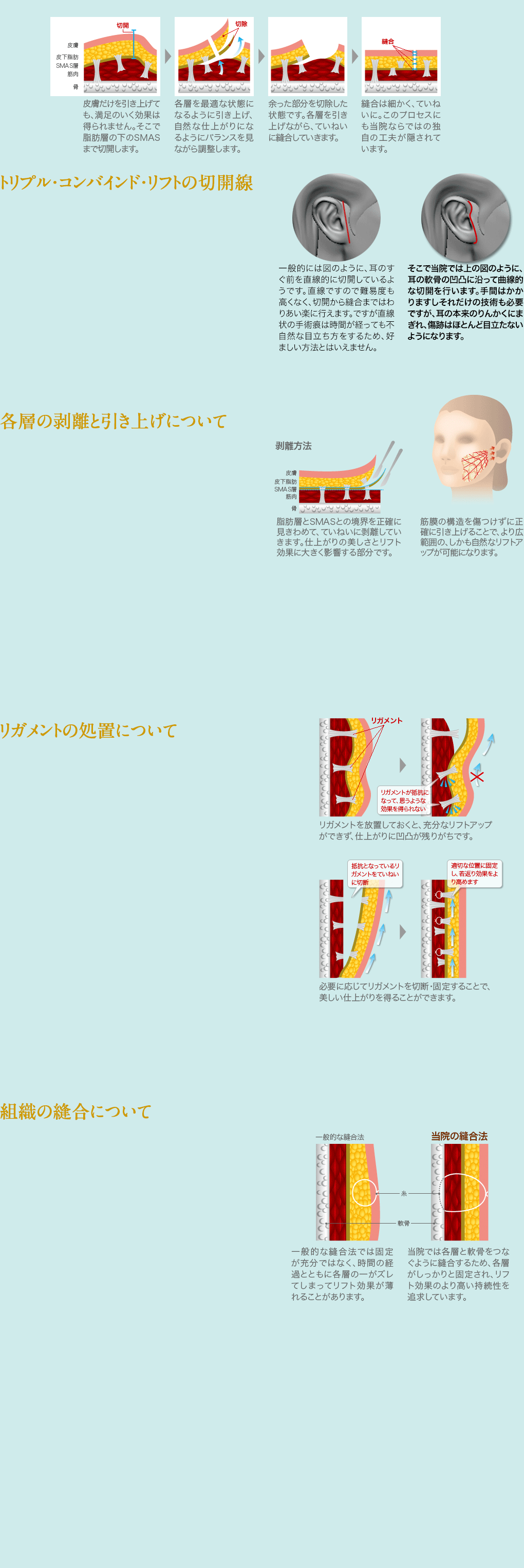 若返り